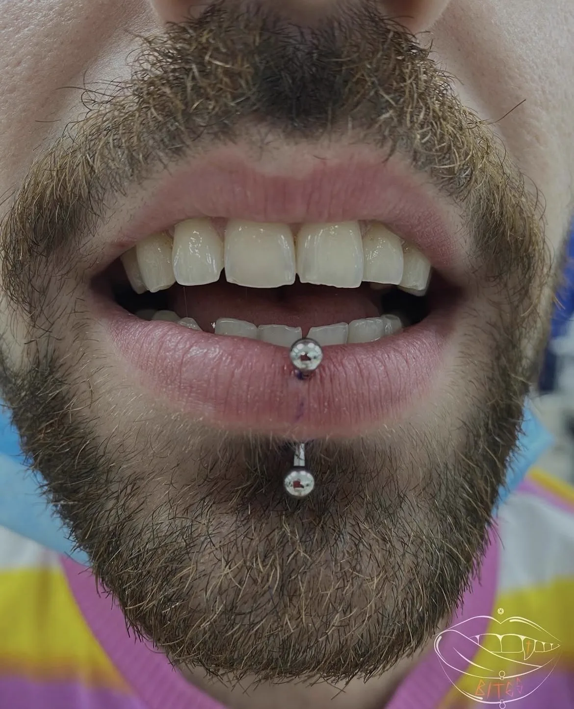 Piercing labret vertical con doble joya realizado por Ana en Black Rituals, Málaga